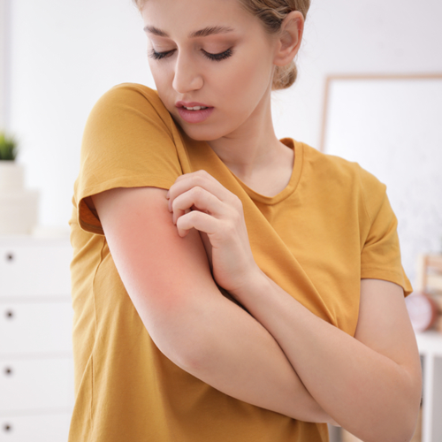 Skin Allergies and Eczema