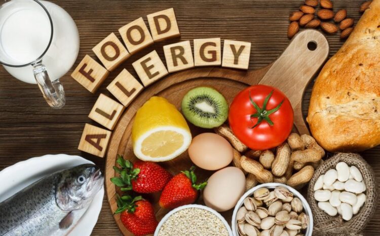  The Role of Food Allergies in Eczema