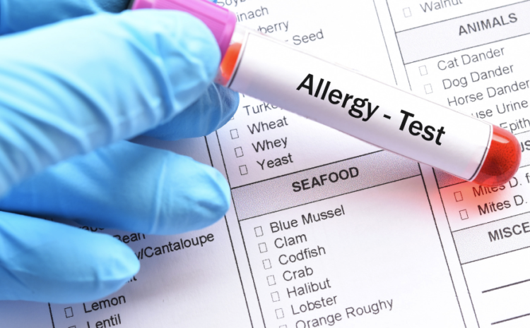  How to Prepare for an Allergy Test and Uncover Your Hidden Allergies